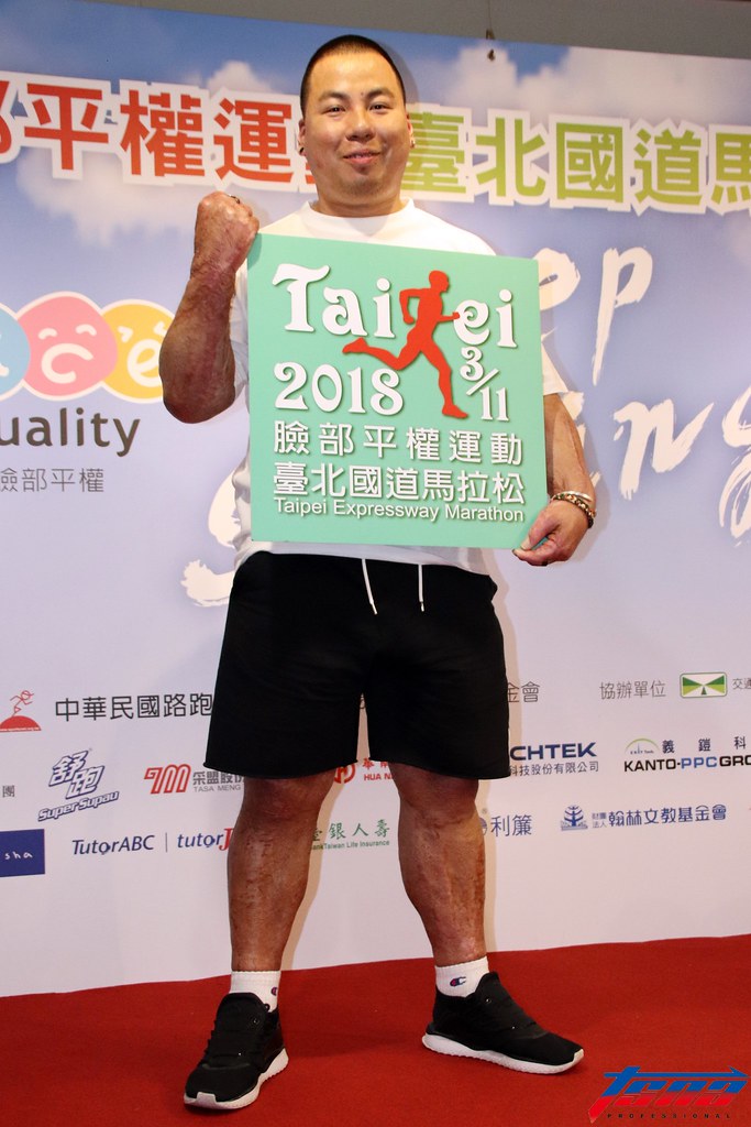 會痛就代表活著　劉嘉舜持續勇於熱愛生命