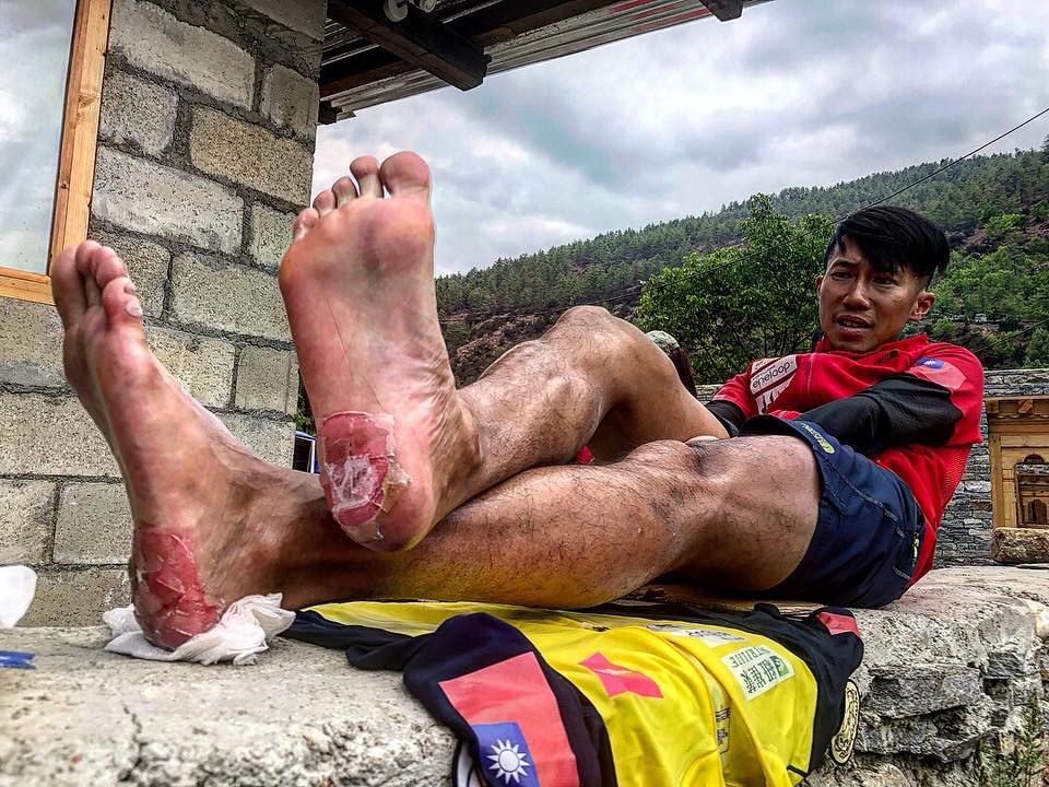 怵目驚心　陳彥博雙腳大脫皮咬牙維持第一