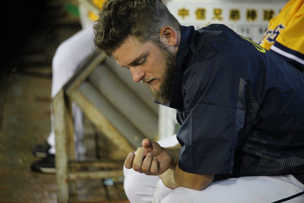 解約肯恩　吳總：他手傷還沒好