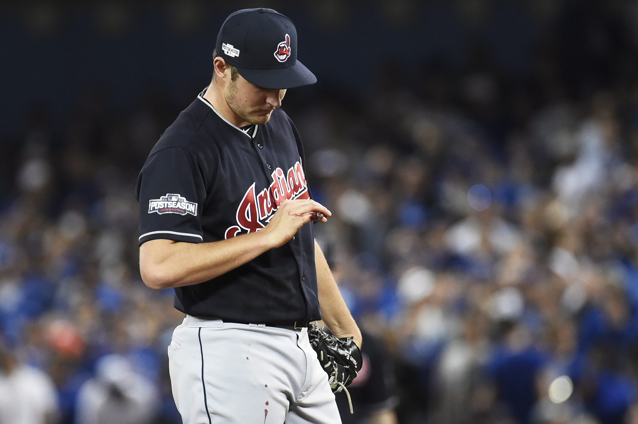 手指傷勢無礙　Bauer次戰先發