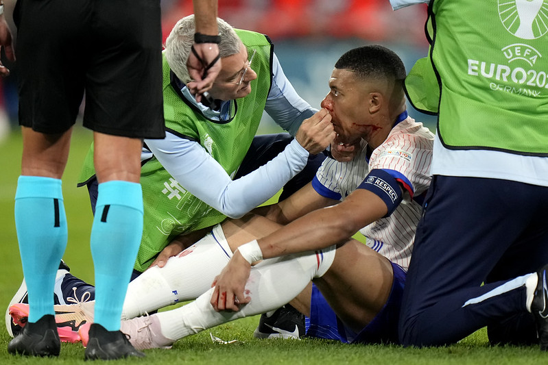 歐洲盃》法國靠烏龍險勝奧地利　 Mbappé鼻子見紅疑骨折